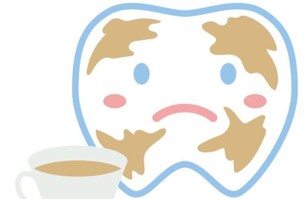 コーヒーによる歯の着色汚れを表したイラスト