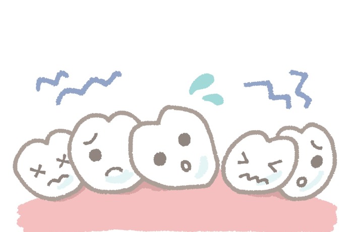 歯並びによって歯周病リスクが高まる様子を表したイラスト