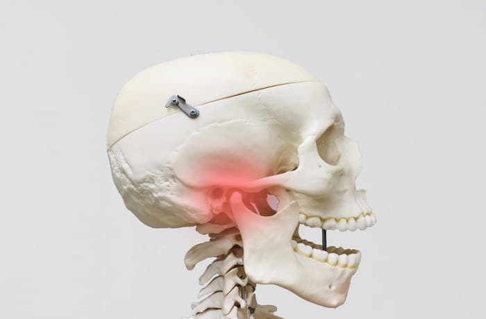 顎関節症（TMJ）とTCH（歯列接触癖）による顎の負担と痛みの関係図