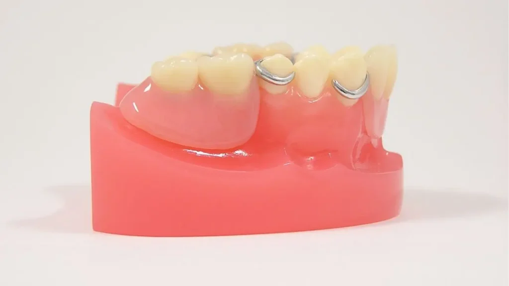 模型の部分入れ歯